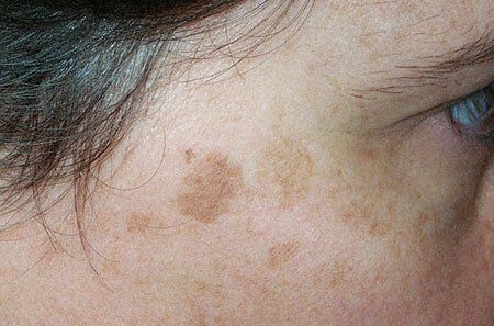 ������ ��������, ������� �������� ���������� �� ���������� �����